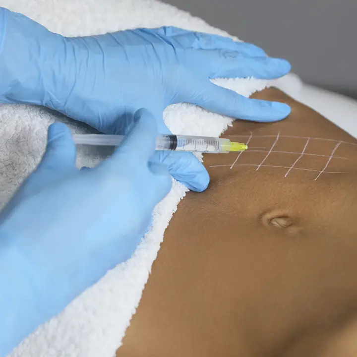 AnyConv.com__Gordura