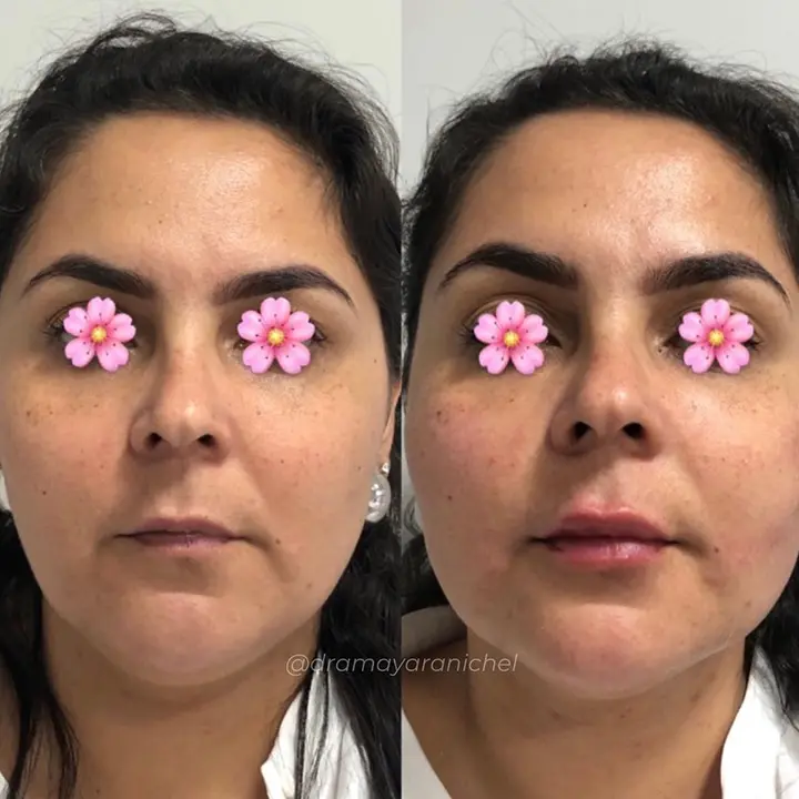 AnyConv.com__bioestimulador