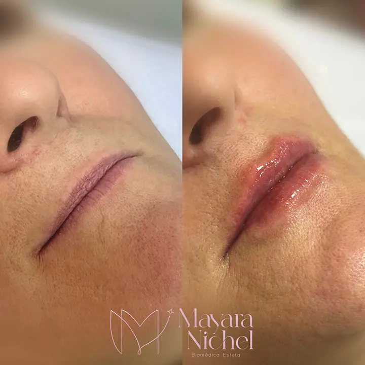 AnyConv.com__labial 2