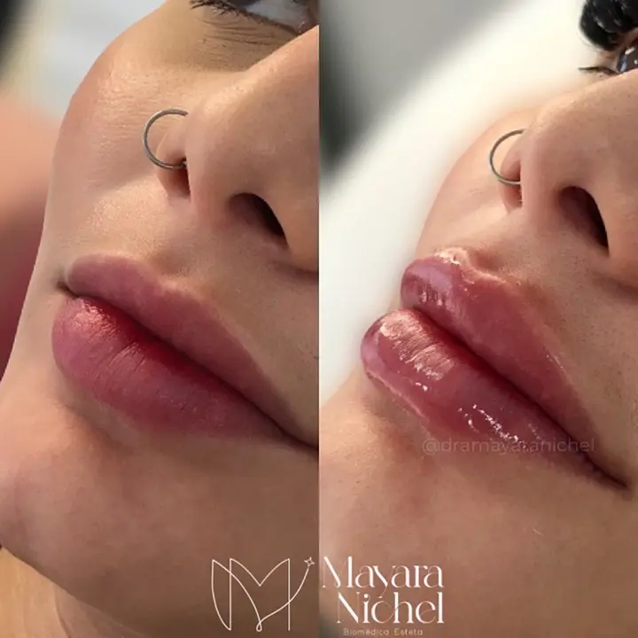 AnyConv.com__labial 3